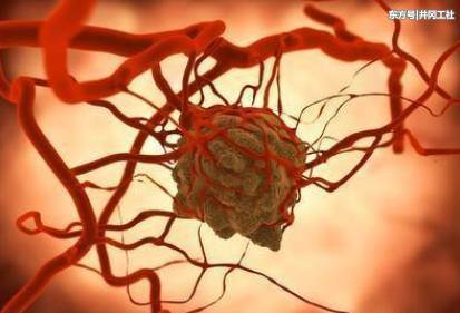 人类什么时候才能攻克癌症?看完心里有谱了!