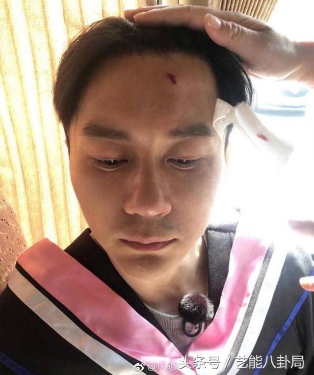 《奔跑吧》又出意外!李晨缝九针,范冰冰的反应