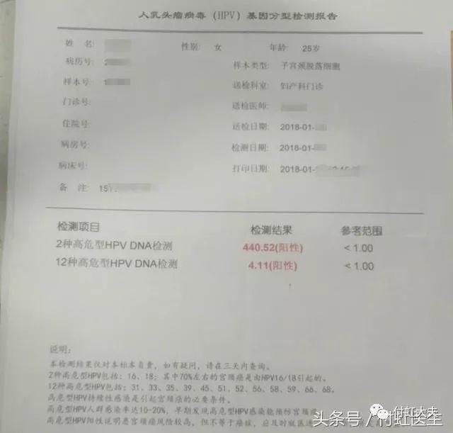 26岁就被查出宫颈癌前病变,医生却说我幸运