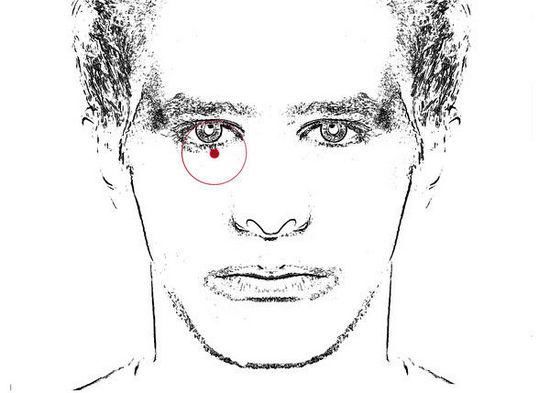 麻衣神婆面部30种痣的位置与命运图解大全