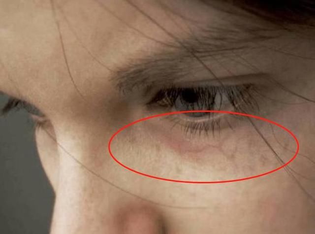 奔4的人,脸上这4个"丑态"你都没有,恭喜,肝脏状态还不错!