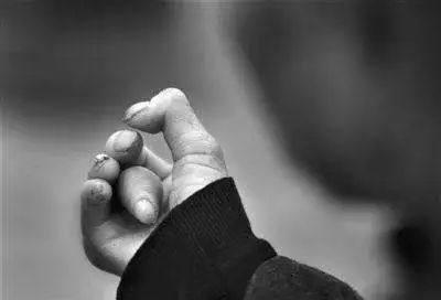 人如果没有了痛觉会怎样?危害超乎你的想象!