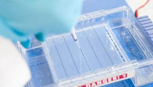 有什么方法能够降低尿蛋白,让你的肾功能持续