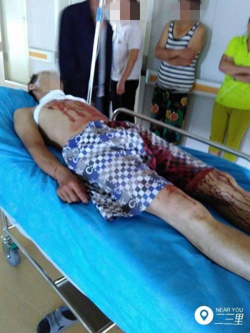 铁岭男子遭妻子用刀 铁岭男子遭妻子用刀
