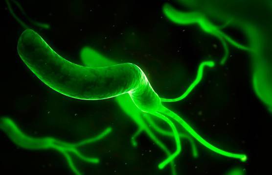 幽门螺旋杆菌到底该不该杀?