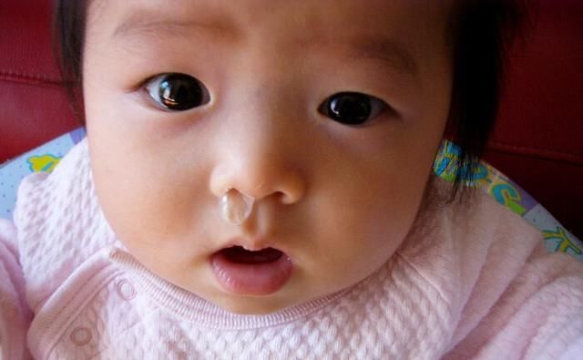 新生宝宝为什么总流鼻涕?宝宝鼻塞,妈妈试试这