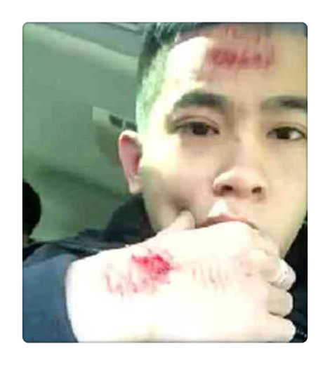 快手主播又出事了,做户外直播竟然被人揍成猪