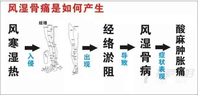 风湿久治不愈? 风湿骨病防治误区