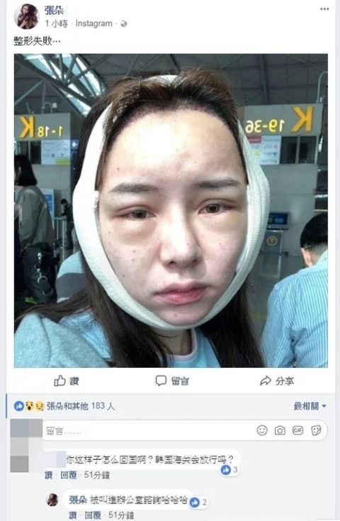 女星赴韩国整容失败 脸过敏肿两倍大被卡海关