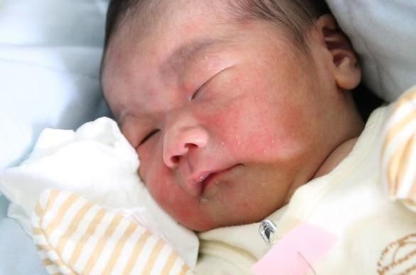 产妇顺产生下男孩,却说怎么没眼睛,医生听完后都笑了