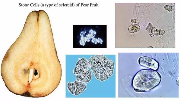 梨果肉石细胞显微图片