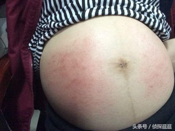 孕妇怀二胎,预产期已过肚子还没动静,去医院一