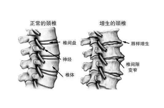 颈椎病引起的头晕,要注意了,可以试试这6种方