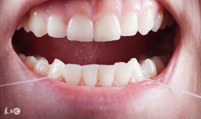 牙上有小沟沟,遇到冷热酸甜就痛,怎么回事?