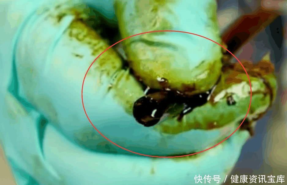 烟民们,吸低焦油和细支香烟危害更小?是时候公