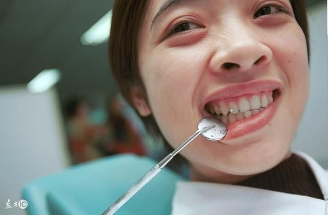 快速消除牙结石的小方法,在家抽出5分钟就能搞