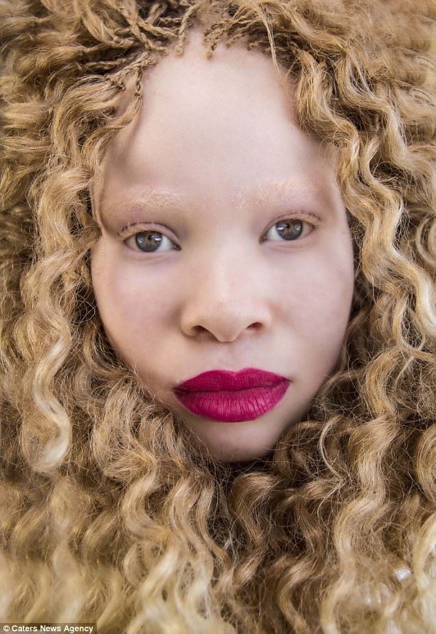 南非女孩患白化病被称幽灵 如今逆袭成模特