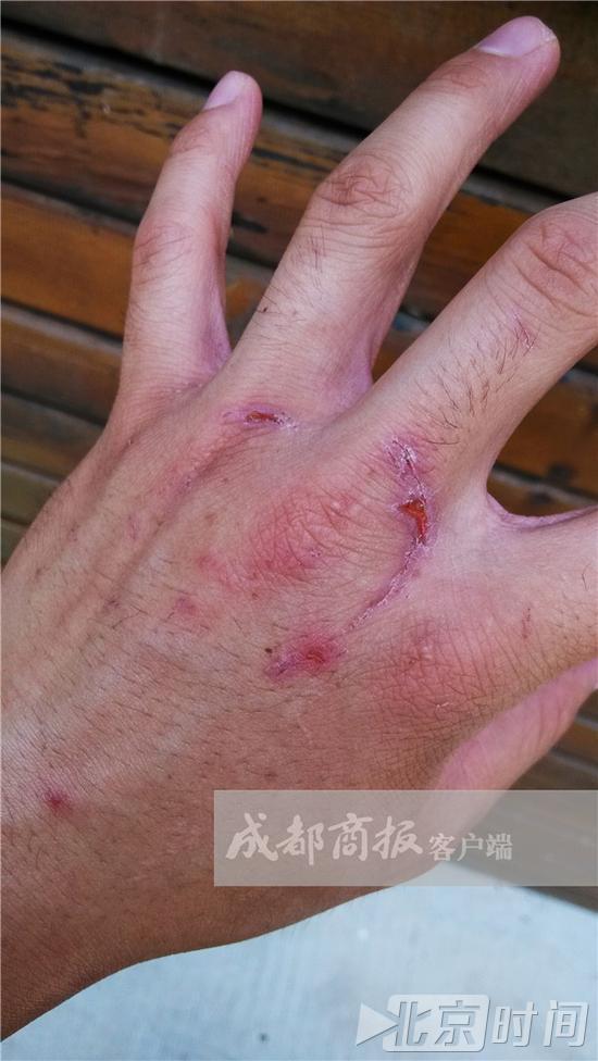 成都大熊猫幼仔被粗暴扔摔当事人熊猫咬人