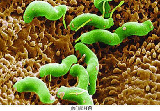 幽门螺旋杆菌到底该不该杀?