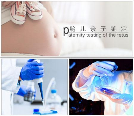 孕期想做胎儿亲子鉴定该怎么办?
