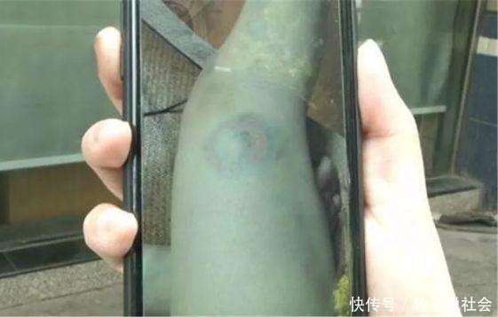 女子哺乳期被丈夫家暴 月子期间被打4次 6个月