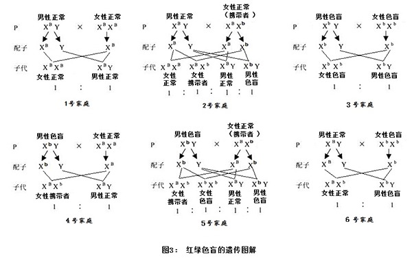 据统计,红绿色盲在男性中的发病率要高于女性,这与红绿色盲基因在