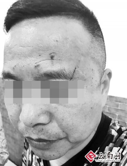 云南一医院领导打医生 院方:打人者已被停职解聘