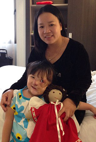 越南5岁女童患致命肿瘤 半张脸被肉瘤覆盖