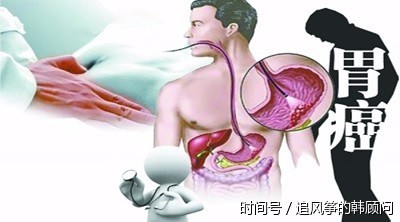 幽门螺杆菌阳性,便潜血弱阳性,是胃癌吗?