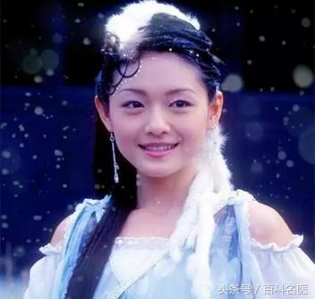 大S癫痫发作晕倒送医?为什么感冒会引起癫痫