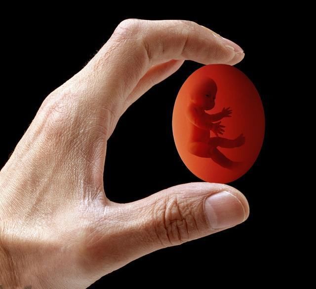 孕早期出血是怀男宝宝的征兆?别傻了,这是胎儿