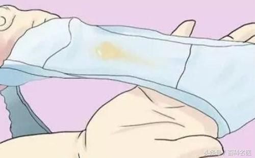 白带带血、像豆腐渣、变黄是怎么了?白带异常