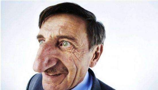 盘点世界上最奇怪的人, 长相似外星人, 还打破吉尼斯纪录!