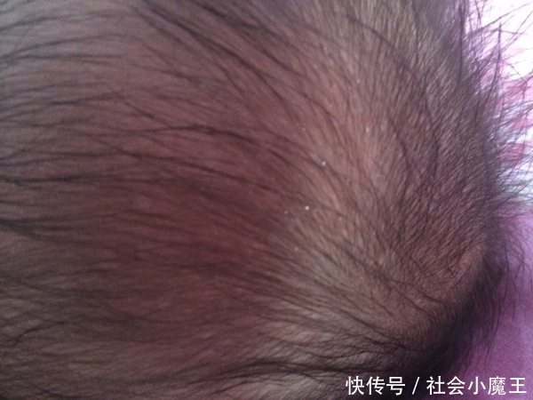 2岁宝宝睡觉冒汗,婆婆立马抱孩子去医院,医生