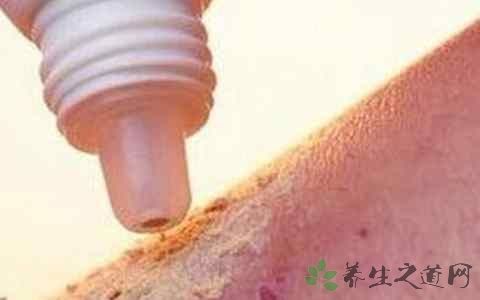 皮炎平和达克宁有什么区别