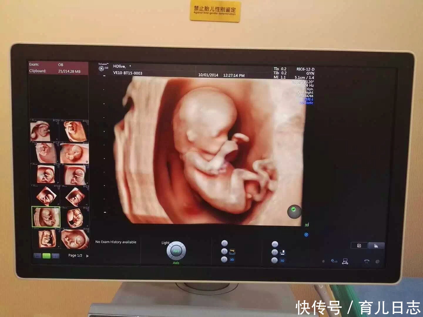 怀孕总想知道胎宝宝的性别?其实,人家b超医生早已暗示给你了!