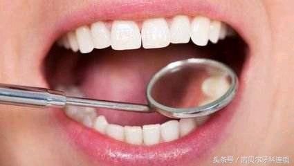 在牙科治疗中能用医保报销么?