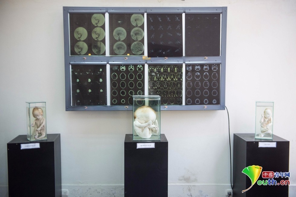 其国际神经病学研究所收集了数千个动物及人类的大脑标本以及畸形胎儿