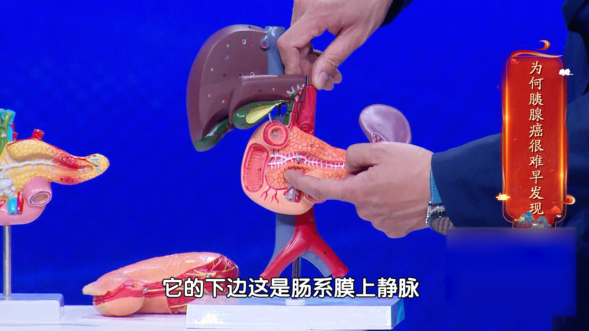 胰腺的解剖结构深在,导致胰腺癌很难早发现,且不好切除_北京时间