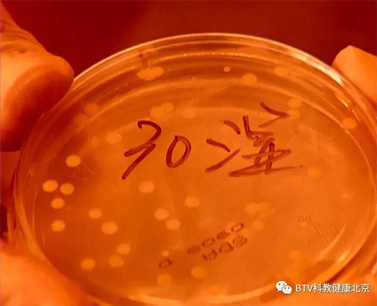 《健康北京》口角开裂查查牙