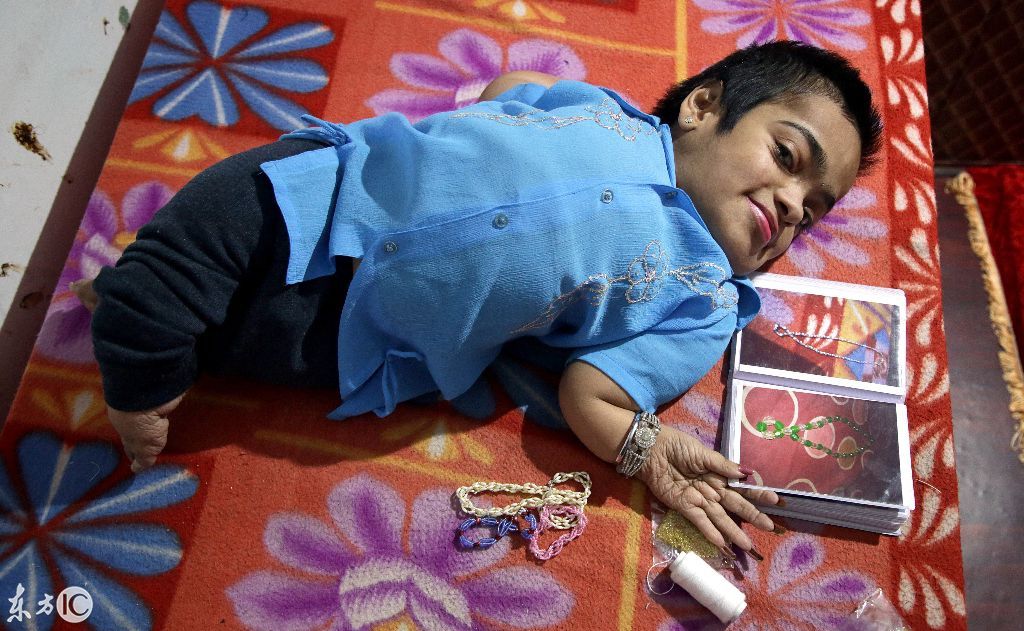 32岁残障女孩没有得到帮助,但她过着尊严的生活!