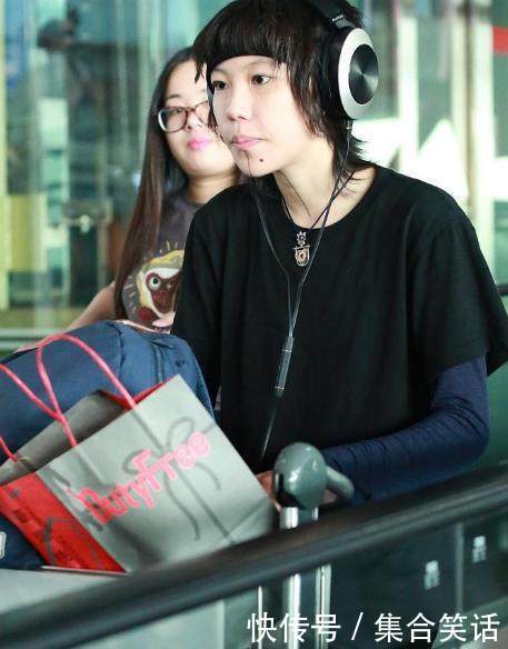 李嫣三次治疗后缺陷消失,变成女神的她坦言我