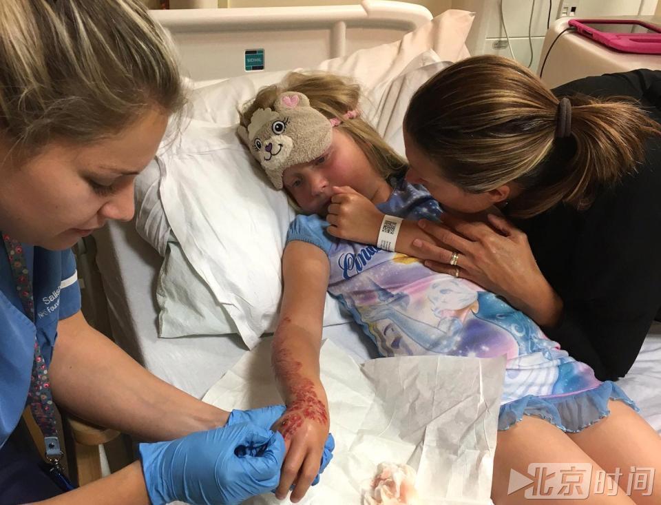 7岁女孩埃及度假手绘纹身 致化学灼伤恐终生留疤