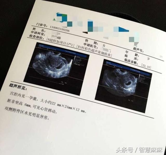 孕妈B超心率范围可以看胎儿性别?医生:没有科