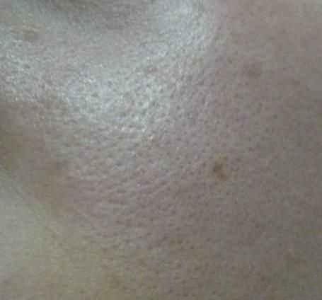 总感觉脸洗不干净,毛孔很多脏东西?你只需要这