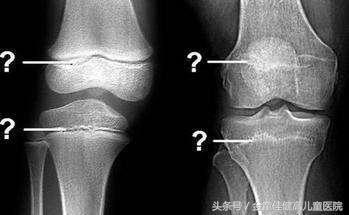 爸爸妈妈都不高,孩子能突破遗传魔咒吗?