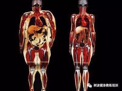 健身基础理论-肥胖
