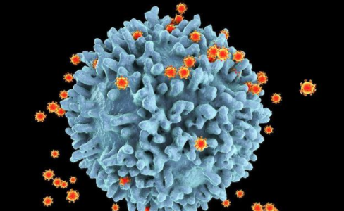 艾滋病患者血常规正常吗?艾滋病无症状期,与常