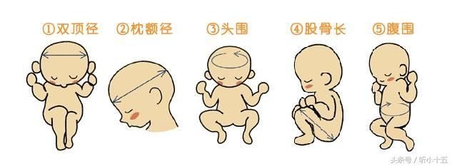 怀孕三个月股骨长多少?如何通过孕检报告判断