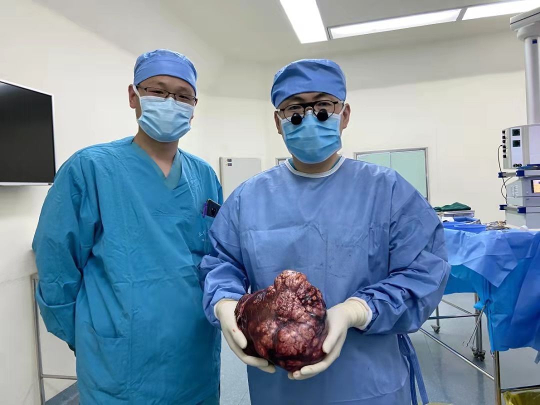 5公斤!好大一个瘤!解放军总医院第五医学中心切除巨大肝脏肿瘤